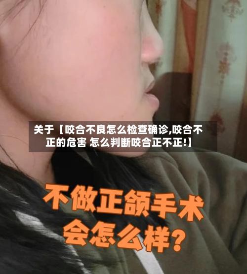 关于【咬合不良怎么检查确诊,咬合不正的危害 怎么判断咬合正不正!】-第2张图片