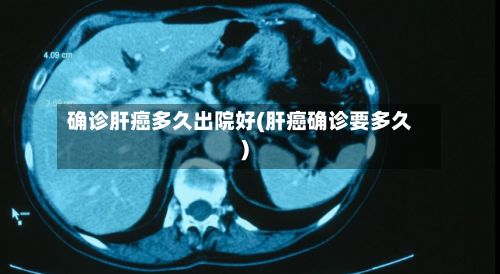 确诊肝癌多久出院好(肝癌确诊要多久)-第1张图片