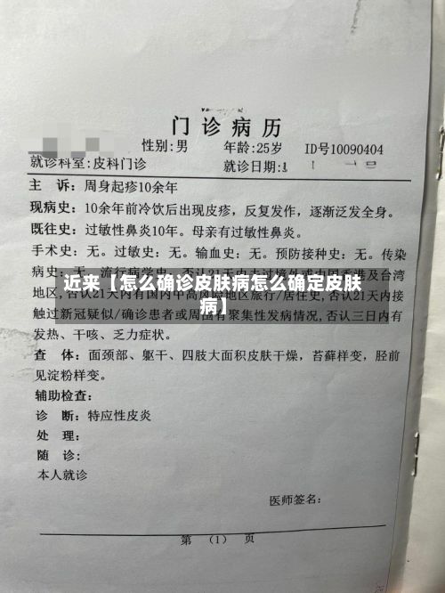 近来【怎么确诊皮肤病怎么确定皮肤病】-第2张图片
