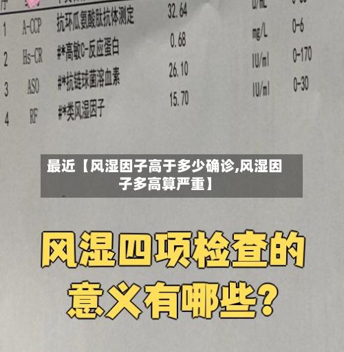 最近【风湿因子高于多少确诊,风湿因子多高算严重】-第2张图片
