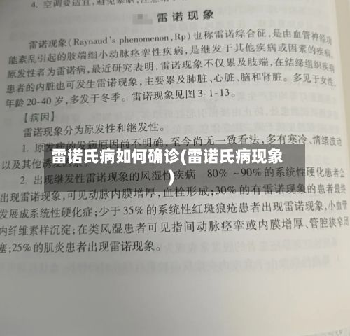 雷诺氏病如何确诊(雷诺氏病现象)