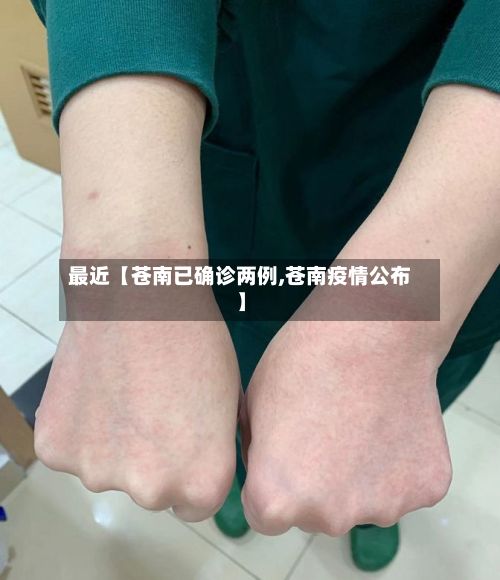 最近【苍南已确诊两例,苍南疫情公布】