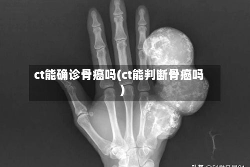 ct能确诊骨癌吗(ct能判断骨癌吗)