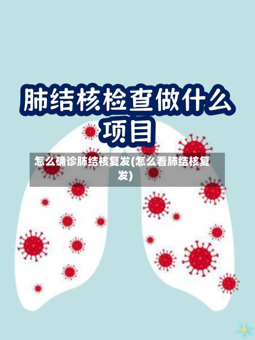 怎么确诊肺结核复发(怎么看肺结核复发)-第2张图片