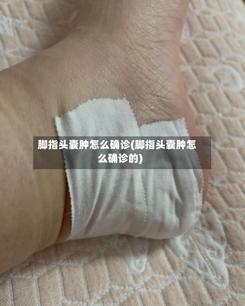 脚指头囊肿怎么确诊(脚指头囊肿怎么确诊的)