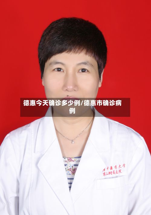 德惠今天确诊多少例/德惠市确诊病例-第3张图片
