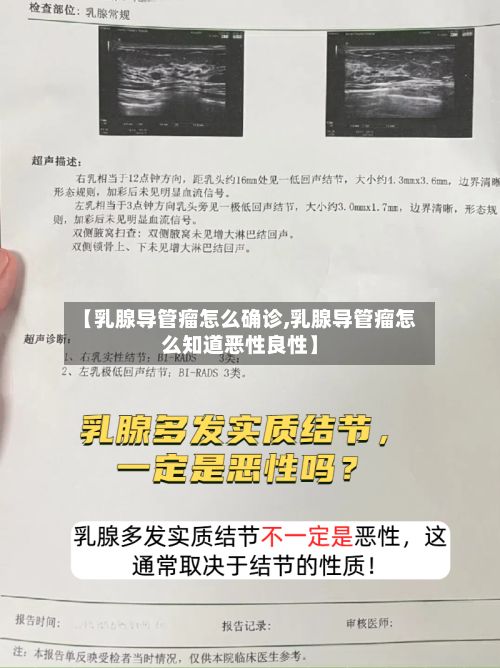 【乳腺导管瘤怎么确诊,乳腺导管瘤怎么知道恶性良性】-第2张图片